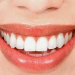 Tác dụng của việc lấy cao răng là như thế nào?